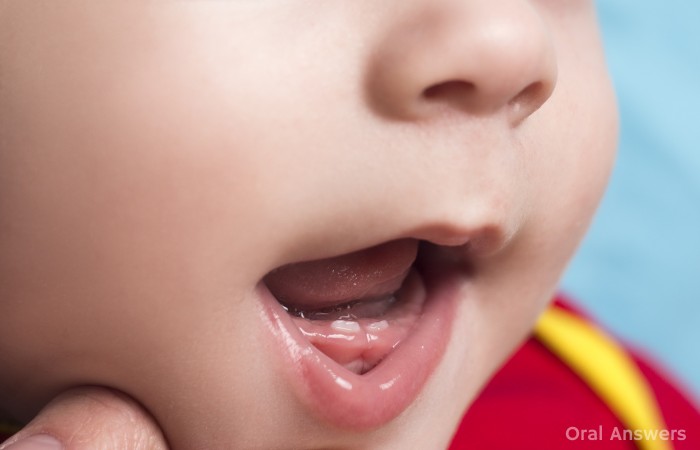 When Should Your Baby s First Tooth Come In Oral Answers