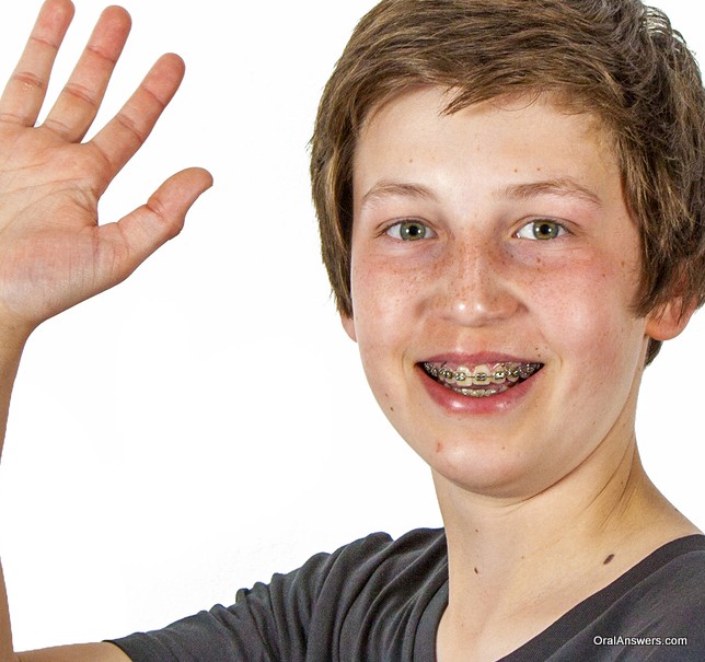 teenage_boy_gray_shirt_braces