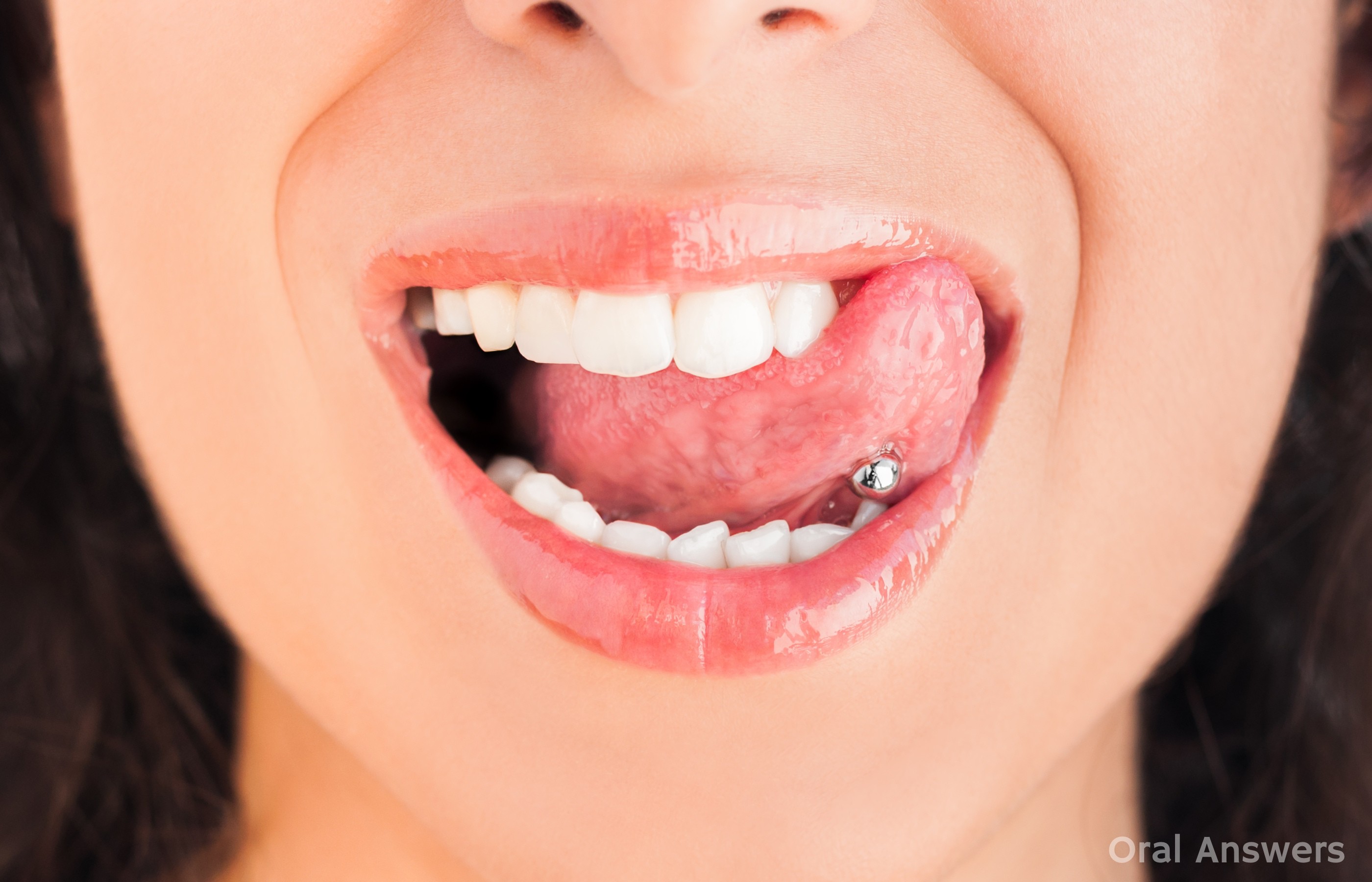 The Risks Of Tongue Piercing 10 Ways It Hurts Your Mouth Teeth 