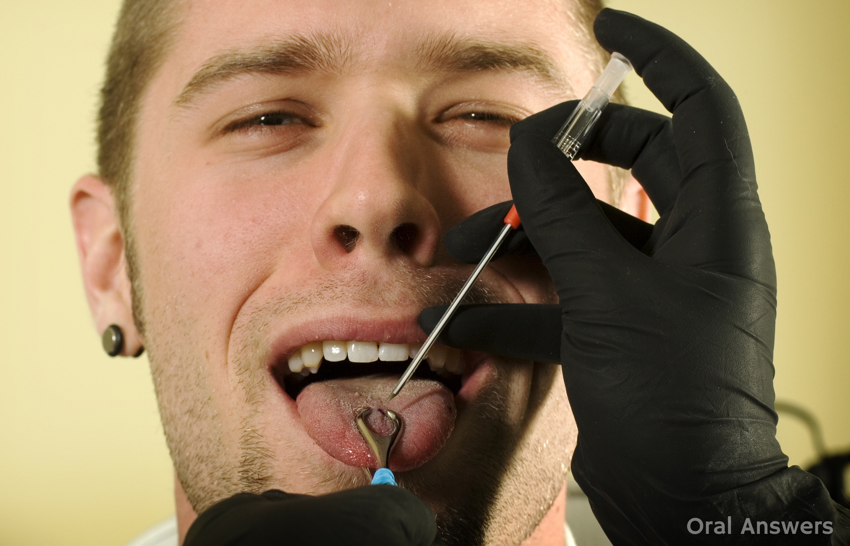 Tongue Piercing Procedure How A Tongue Gets Pierced Oral Answers